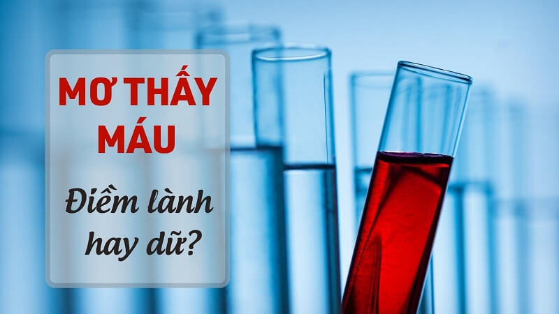 Ý nghĩa giấc mơ thấy máu là điềm lành hay dữ?